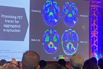 An audience looking at brain images from a PET scan on a large presentation screen