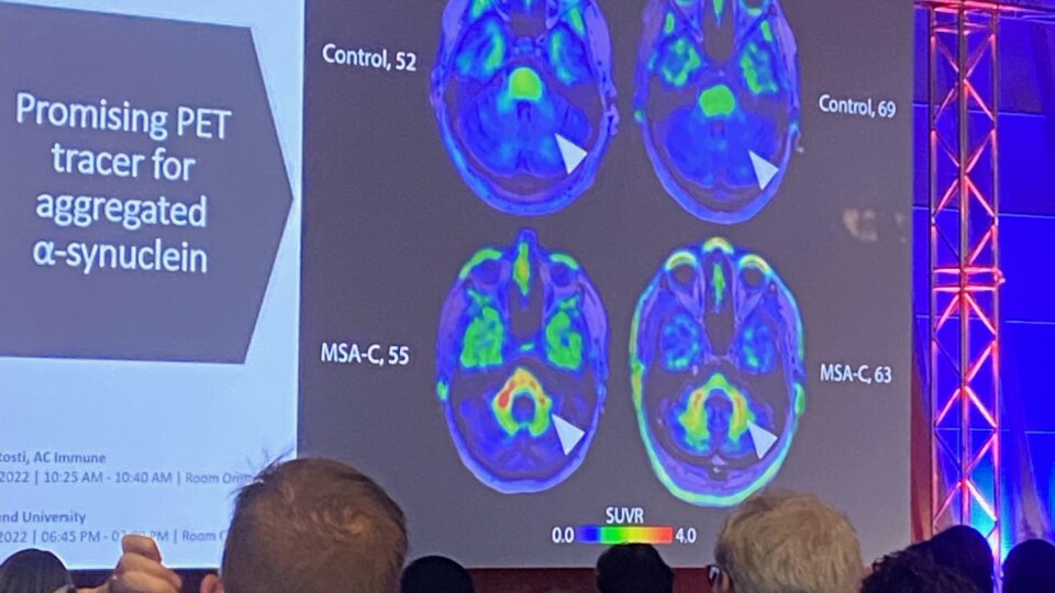 An audience looking at brain images from a PET scan on a large presentation screen