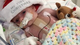 An infant with serious heart defects recovering post-surgery