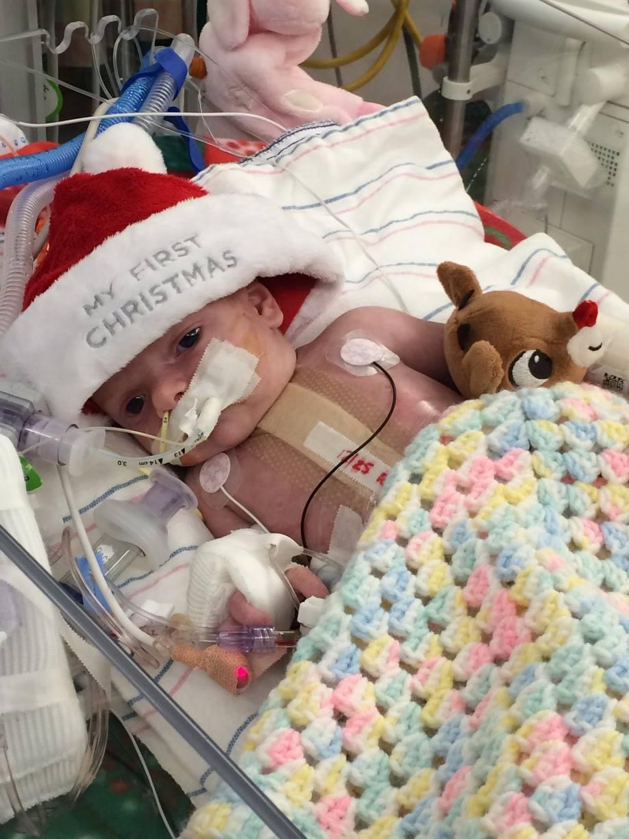 An infant with serious heart defects recovering post-surgery